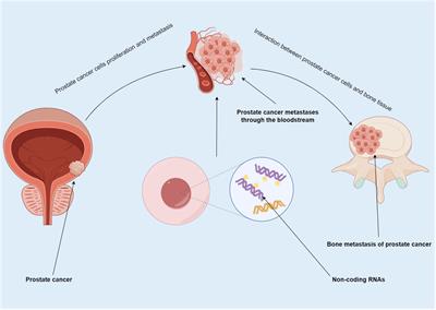 The regulatory process and practical significance of non-coding RNA in the dissemination of prostate cancer to the skeletal system